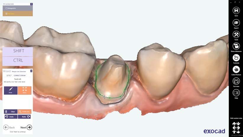 Exocad Fiyatı